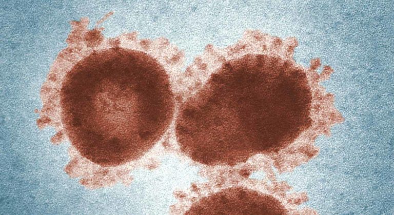 1,000 Chile Smes Get Aid. What’s The Best Latam Country To Be A Covid-era Startup?